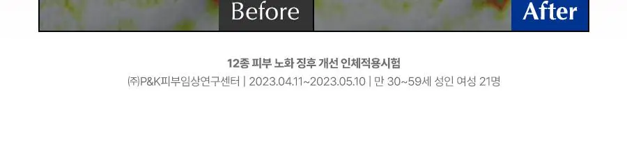 [속광탄력] 닥터지 블랙스네일 레티놀 앰플 50ml 증정 기획 (+마스크팩 1매) 상세페이지 24